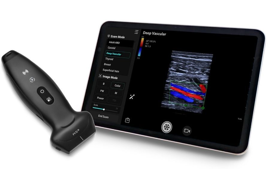 Ultralydsscanner TE Air.0